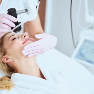 Aparat de tratament Laser CO2 – Clinica Dermestetica