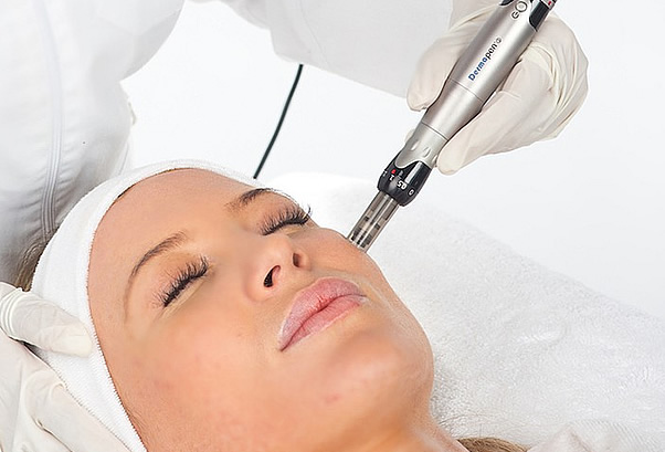 Microneedling DermaPen. Indicatii. Beneficii.