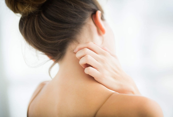 Psorizais. Tipuri psoriazis si tratament psoriazis. Ghid complet psoriazis